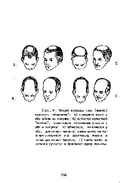 Современный опыт дерматологии. Научные основы борьбы с облысением